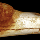 A cancerous foot bone belonging to a 1.7 million year old hominid. (Image: Edward J. Odes et al., 2016)
